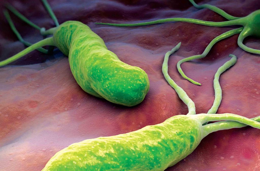 Што е Helicobacter pylori? Со овој пијалок може да ја излечите природно…
