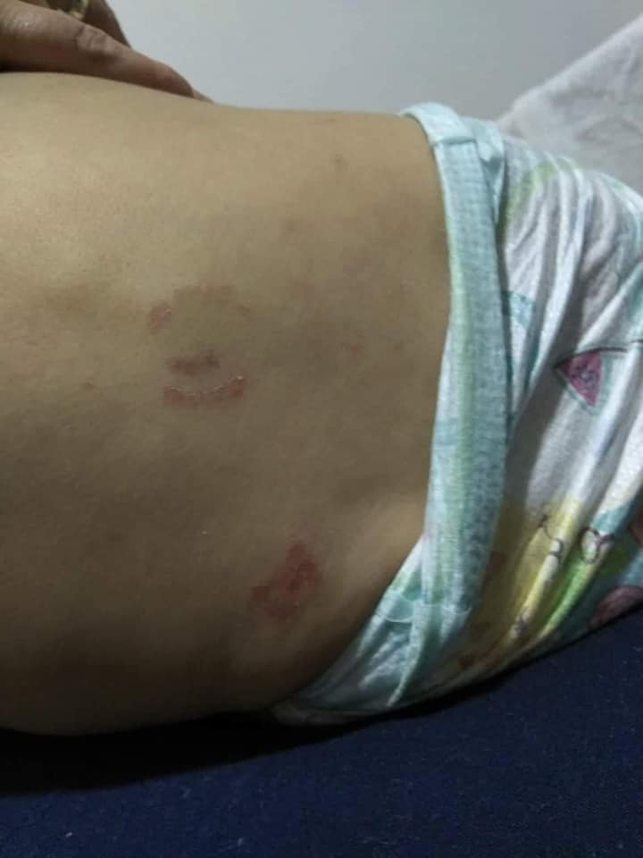 Скандал во детска градинка во Скопје, бебе изгризано, воспитувачките молчат, МТСП работеле на случајот!