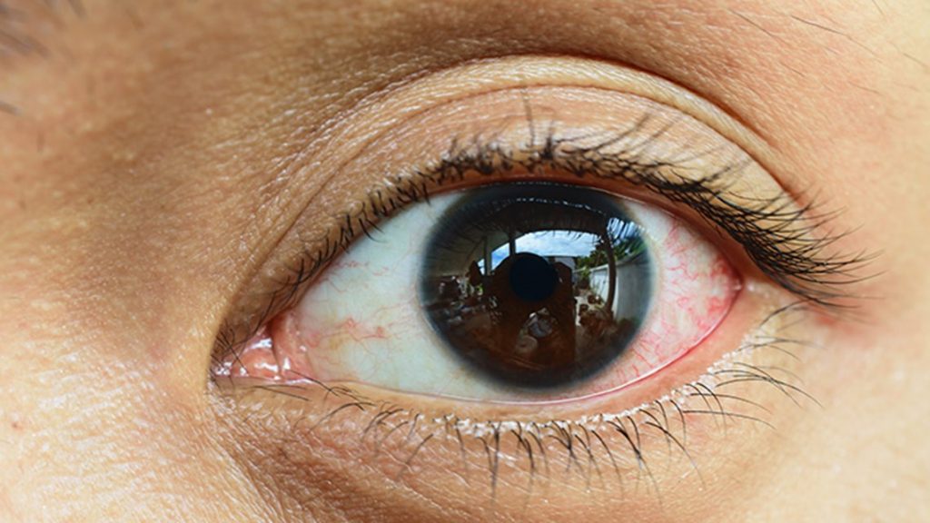 Што сè влијае на здравјето на очите?