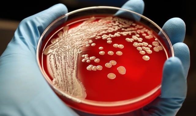 Во ОУ „Лирија“ владее бактеријата „МРСА“: Нема простор за паника, според општина Чаир тоа е само обична бактерија