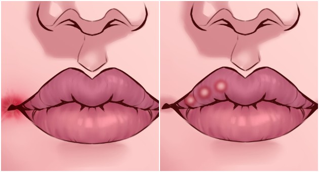 Промени на усните што можеби укажуваат на некаков здравствен проблем