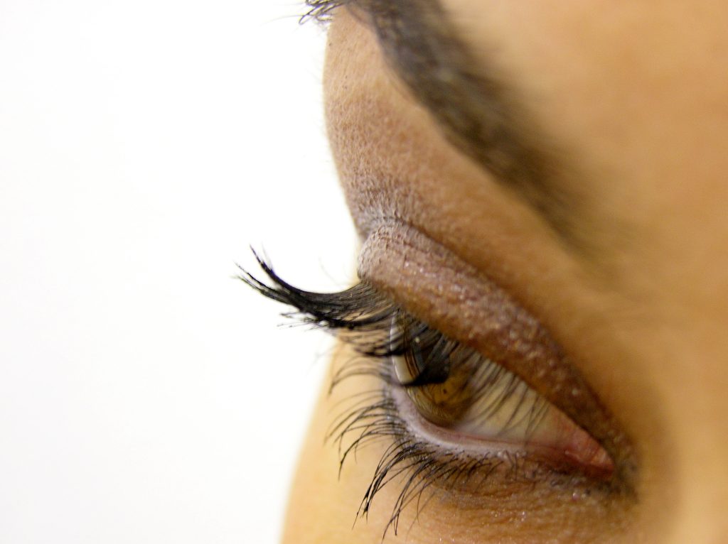 Израстоци на очните капаци (ксантелазми) – 10 совети за нивно отстранување