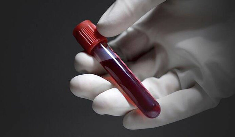 Зошто треба да ја знаете своја крвна група?