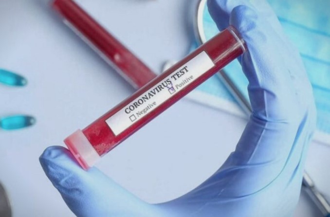 Потврден првиот случај на коронавирус во Грција