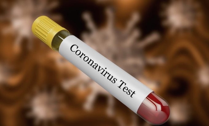 Загрижени сте поради коронавирусот? Прочитајте што вели популарниот доктор наречен “ловец на вируси“