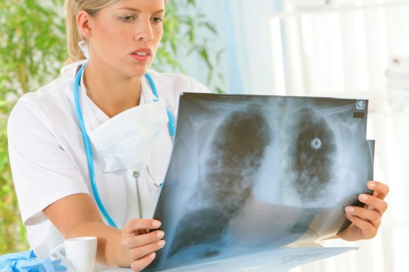 Еден знак на вашето лице кој сигурно го занемарувате може да биде симптом за рак на белите дробови