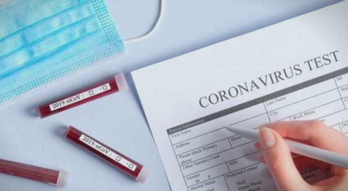 Состојба до 10 часот: 723.732 заболени од коронавирус во светот