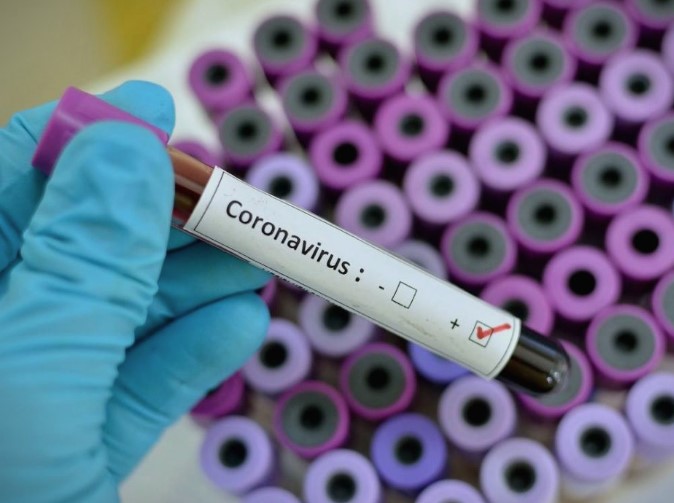 Втора жртва на коронавирусот во Србија