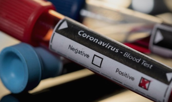 Бројот на заразени од коронавирусот во Косово се зголеми на 13 лица