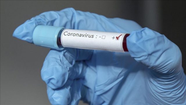 Дефинирана листа со хронични болести за ослободување од работа поради коронавирусот