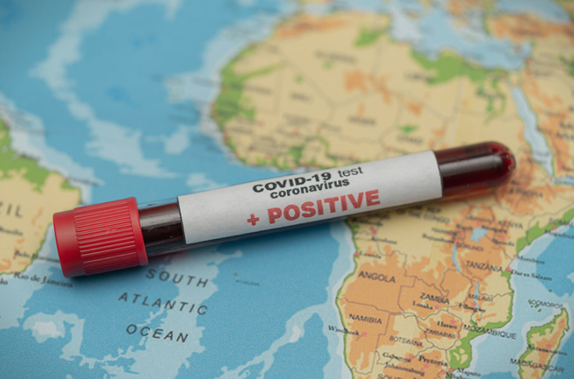 ОН: Пандемијата може во Африка да убие 300.000 луѓе