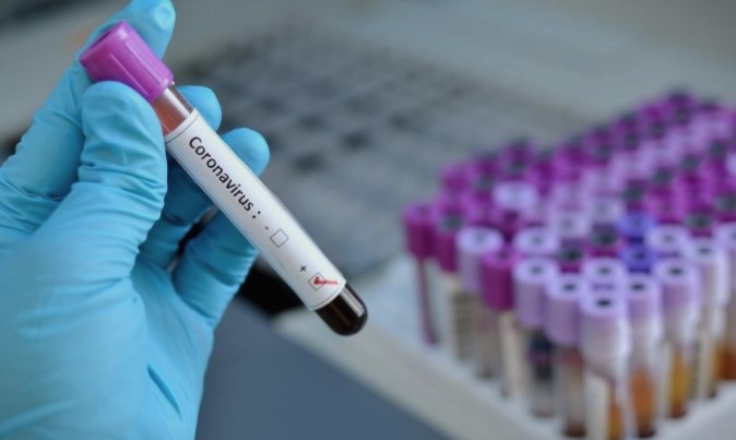 Во БиХ досега 882 лица заразени со новиот коронавирус