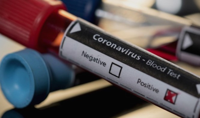 АлсатМ: Нови 26 случаи на коронавирус во земјава, почина еден пациент во Скопје