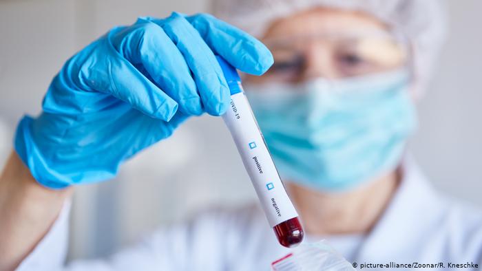 Српски доктор открива дека е можно да имате коронавирус, но тестот да биде негативен