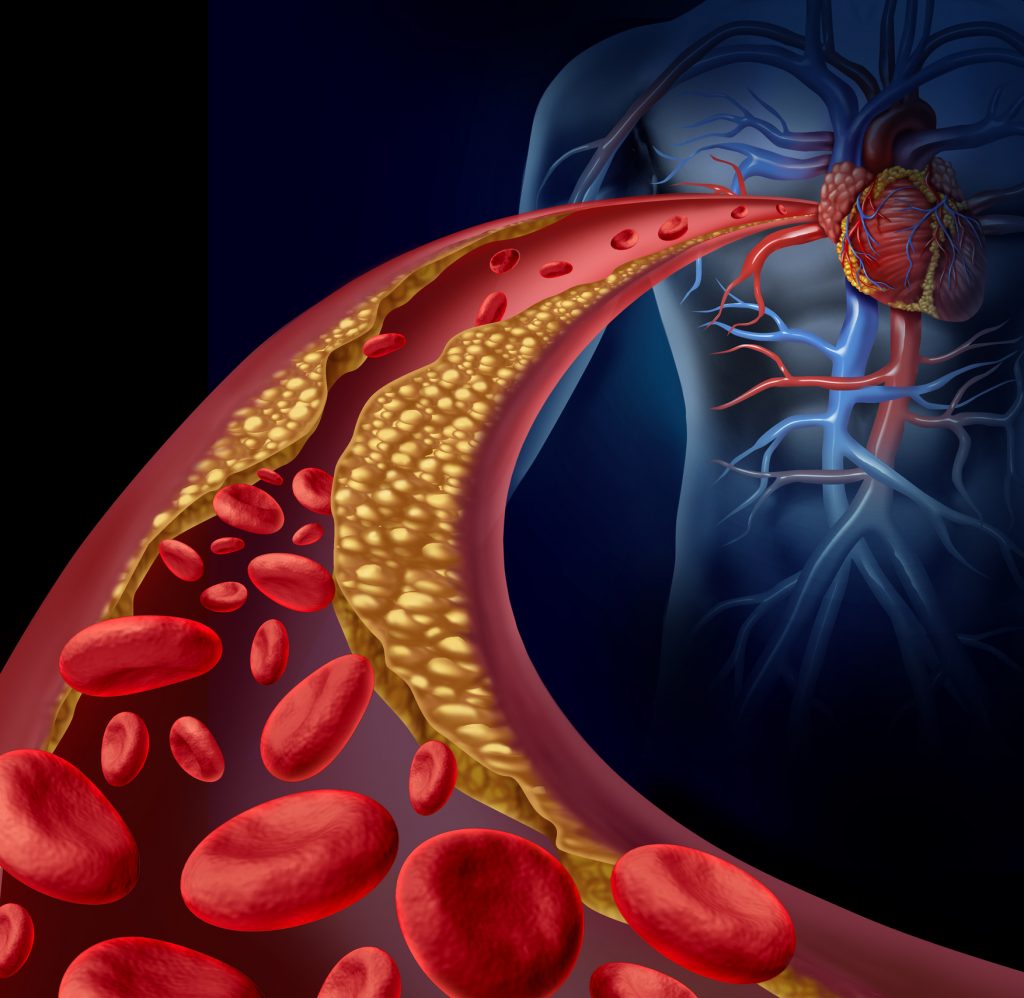 Триглицеридите имаат значајна улога во развојот на болести на срцето и крвните садови