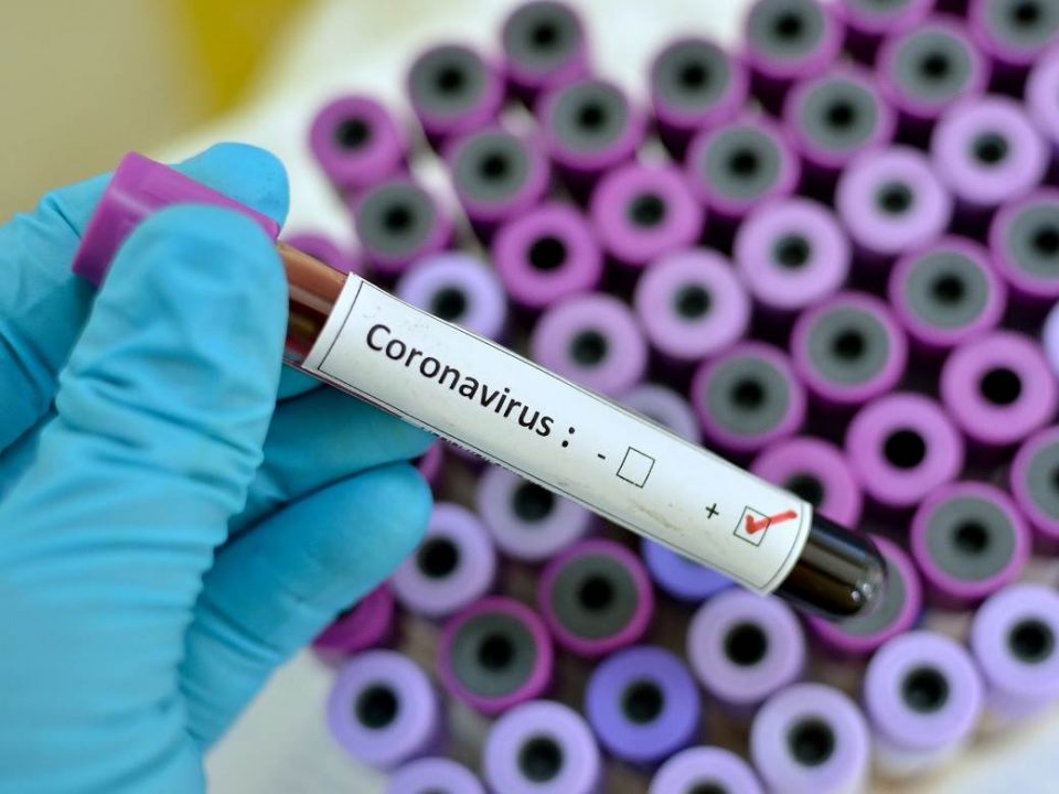 Од коронавирус се заразија нови 214 случаи, а 8 лица починаа