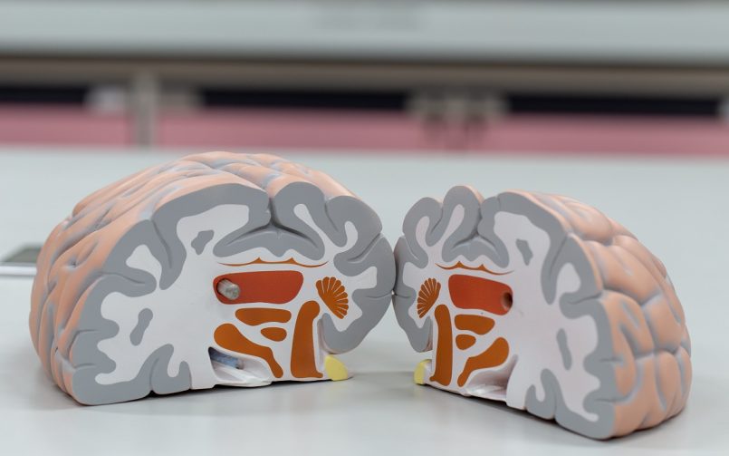 Ковид-19 може да предизвика намалување на сивата маса во мозокот