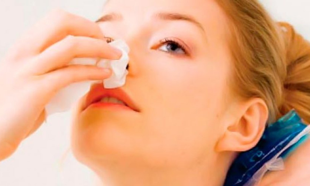 Кои се причините и што треба да направите ако ви тече крв од носот