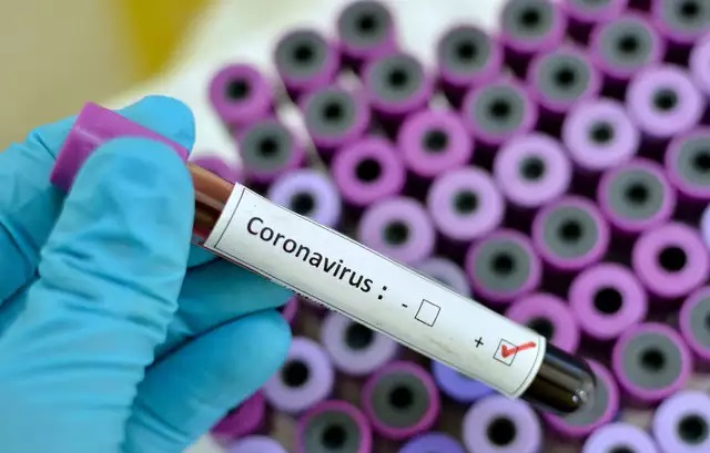 ИЈЗ: Во периодот од 26 декември до 1 јануари регистрирани се нови 254 заразени со ковид-19