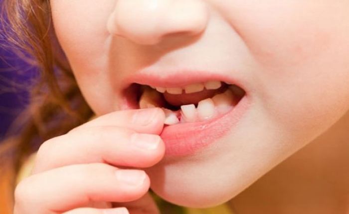 Кога паѓаат млечните заби кај децата и зошто е важна оралната хигиена уште од најрана возраст?